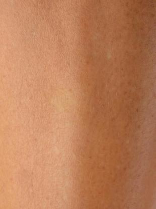 dry-skin-before-after-moisturizing-treatment_651462-463.webp_1