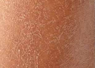 dry-skin-before-after-moisturizing-treatment_651462-463_1