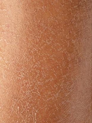 dry-skin-before-after-moisturizing-treatment_651462-463_webp